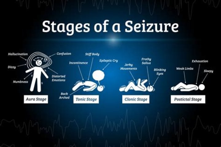 Can a seizure look like shivering?