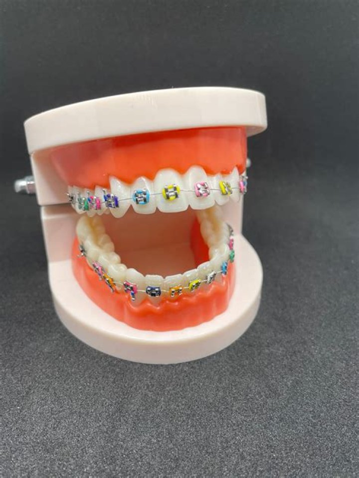 Can u buy fake braces?