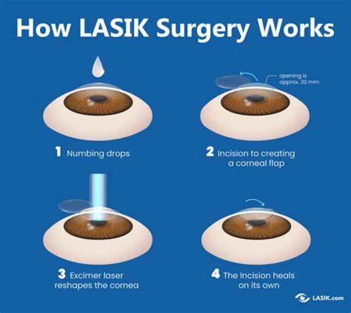How many days rest is required after laser eye surgery?