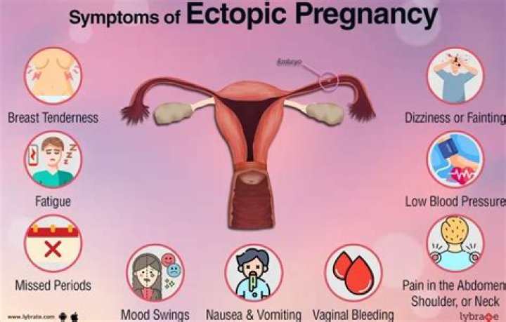 How soon can you have intercourse after an ectopic pregnancy?