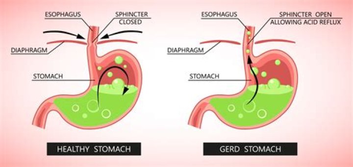 What causes hardening of stomach lining?