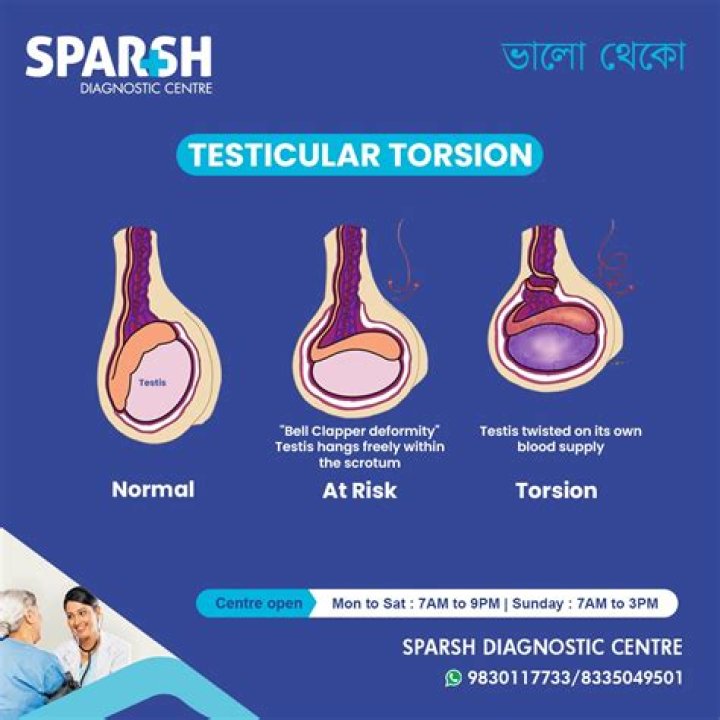 What is connected to my left testicle?