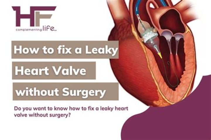 What is the correct code for a leaking heart valve prosthesis initial encounter?