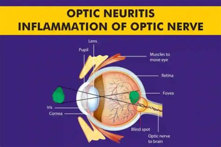What toxins can cause optic nerve damage?